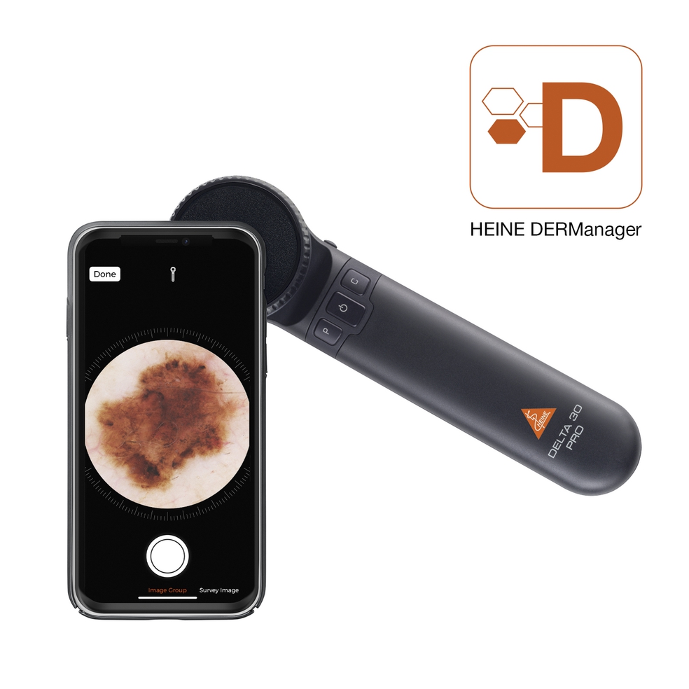 K-235.28.305-HEINE-dermatoscope-DELTA30-PRO