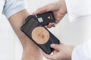 HEINE DeltaONE Dermatoscope