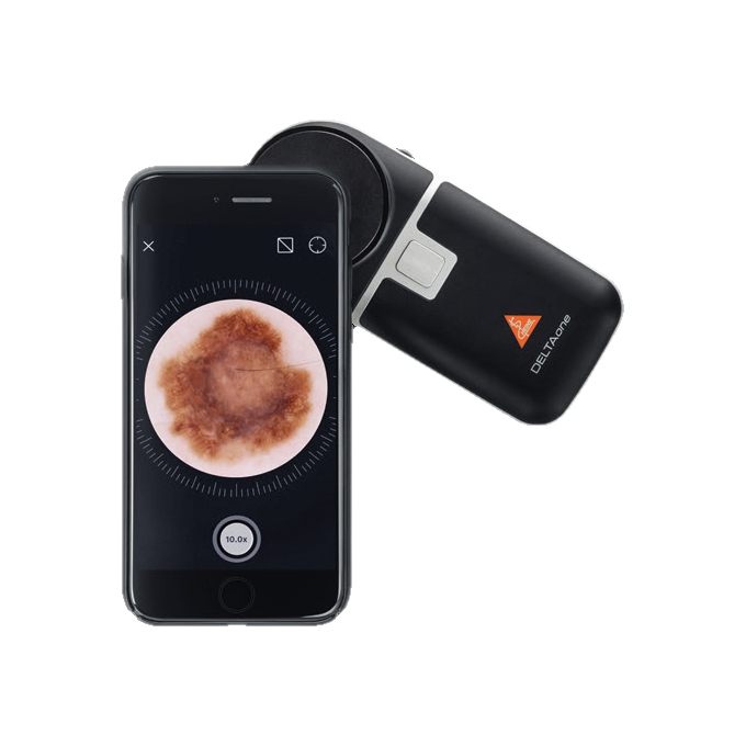 HEINE DELTAone Dermatoscope with iPhone