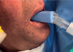 BiteMe - Perioperative Bite Block