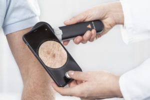 HEINE DELTA30 Dermatoscope