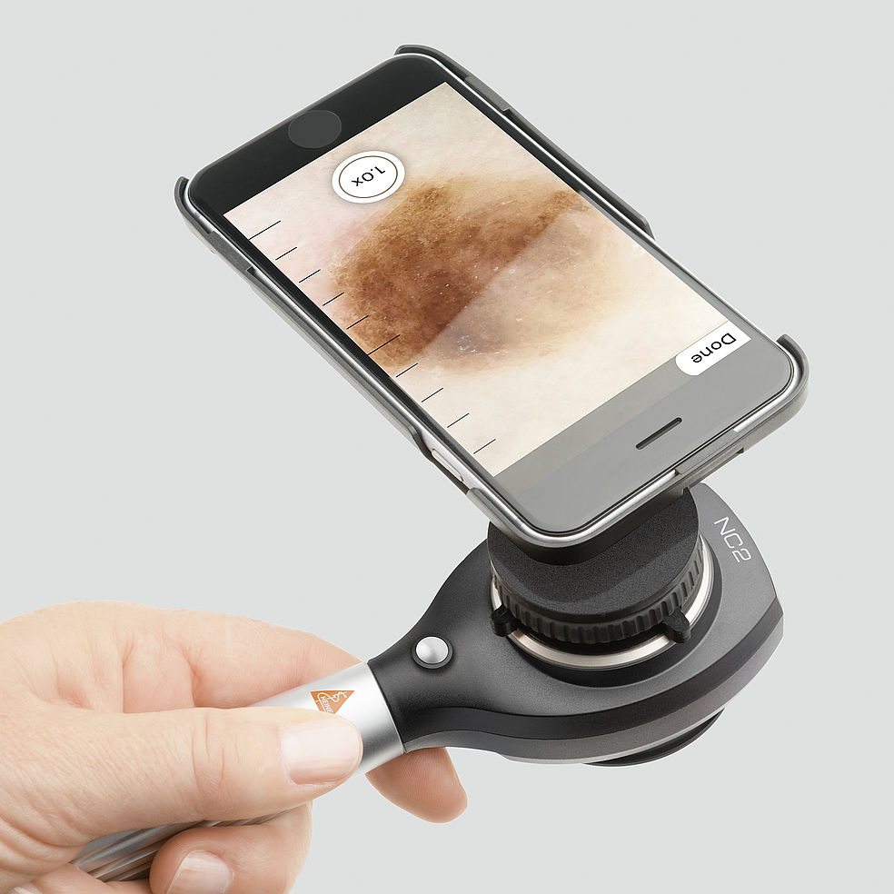 Heine® NC2 Dermatoscope
